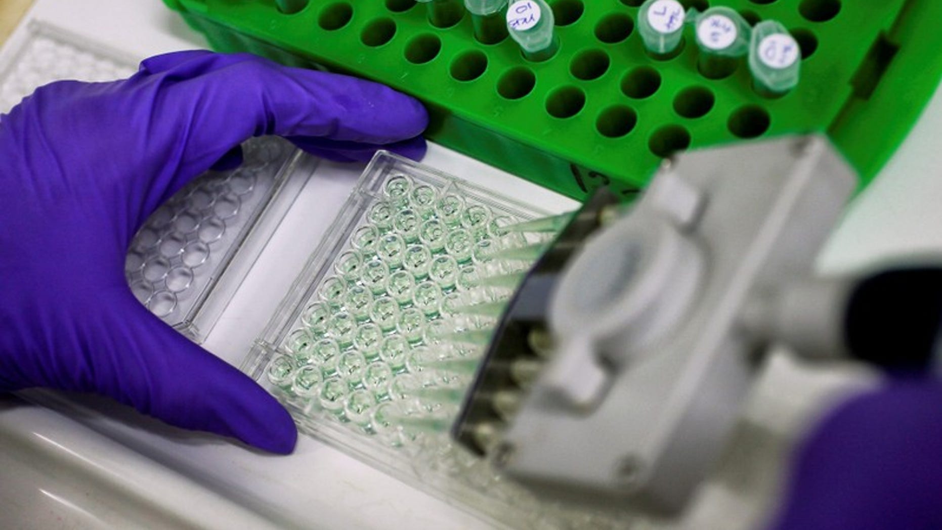 FILE PHOTO: Scientist prepares protein samples for analysis in a lab at the Institute of Cancer Research in Sutton, Britain.