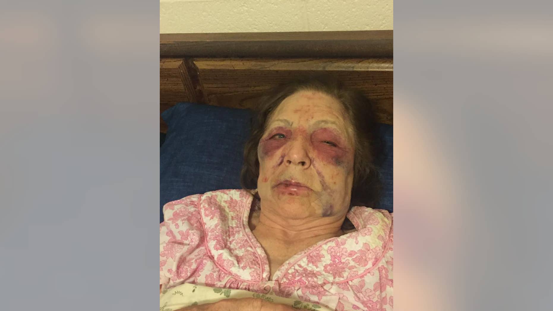 An 82-year-old grandma was beaten in her home in Arizona late Friday night.
