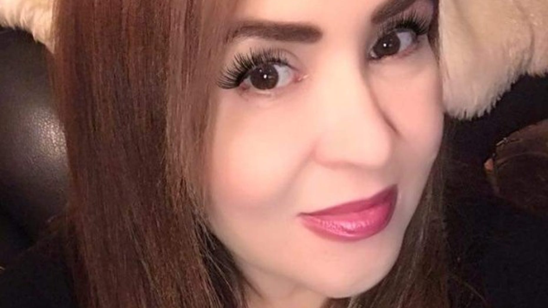 Irma Saenz died on Saturday after a botched plastic surgery in Mexico, her family said.