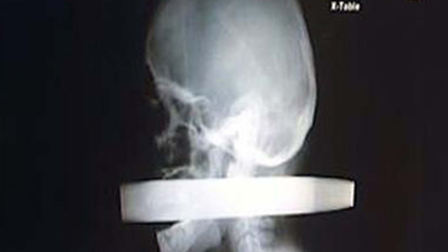 Andrew Linn's X-ray
