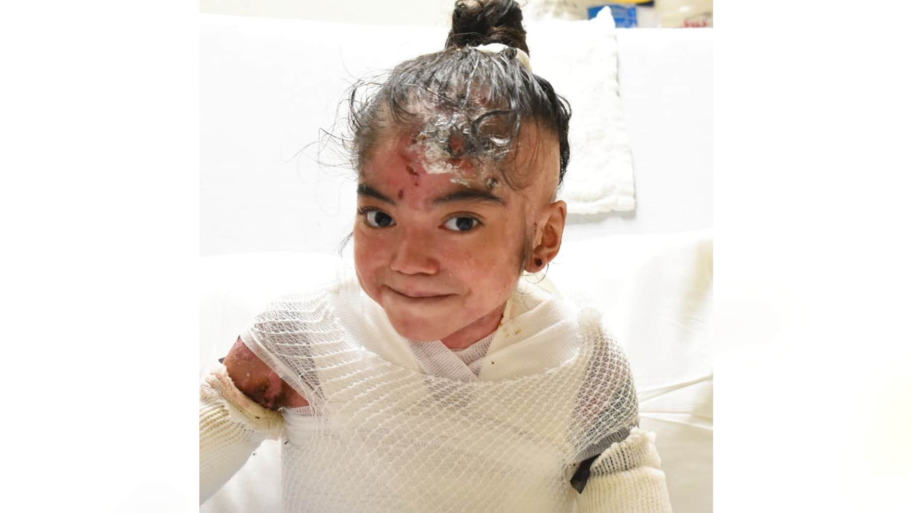 “I don’t remember a day without pain,” Destiny said of her life with the genetic tissue disorder epidermolysis bullosa (EB).
