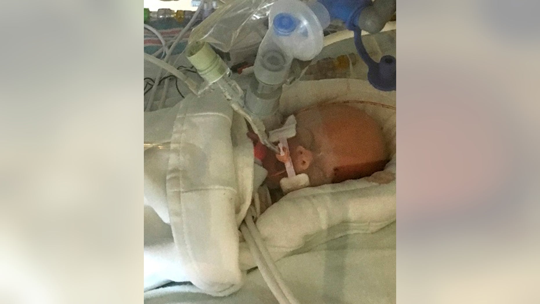 Life Lynn was born at 24 weeks gestation after her mother fell into a coma while battling brain cancer. Her aunt announced her death in a Facebook post on Thursday.