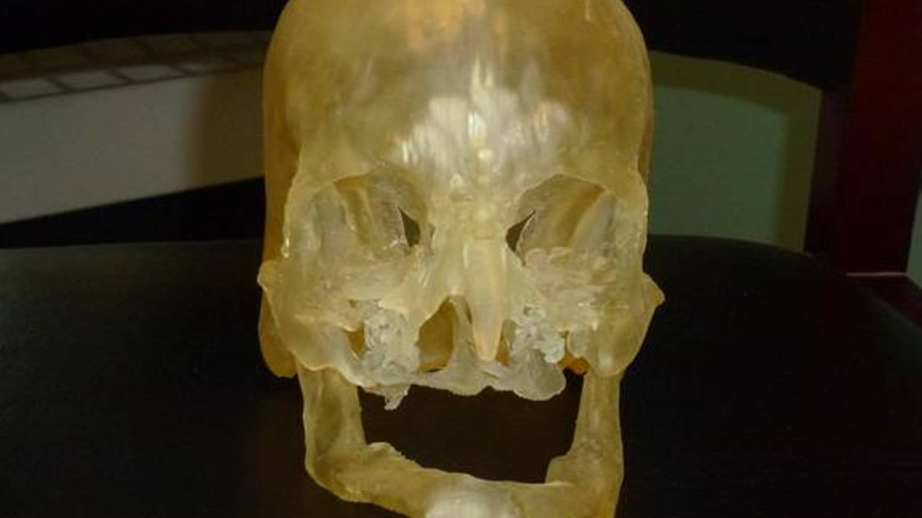 This is a 3D printed model used in planning a face transplant surgery.