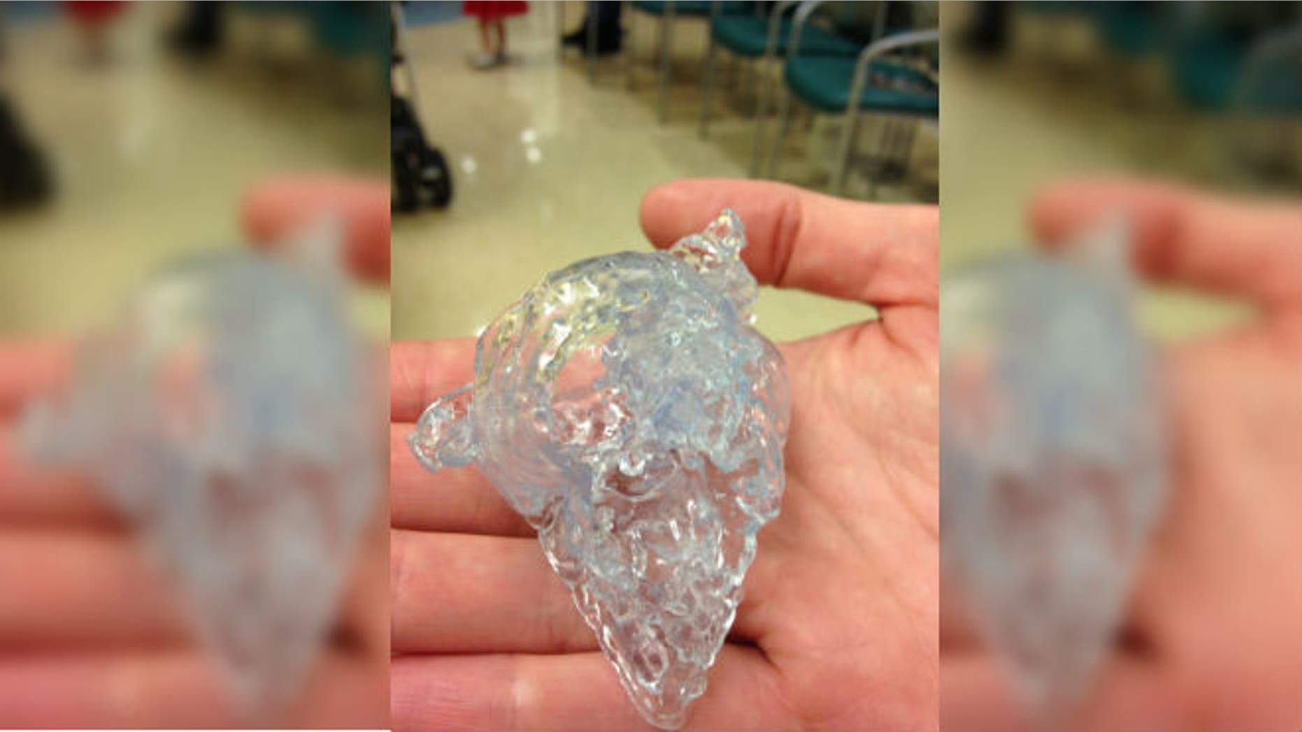 This 3-D printed plastic heart was studied by a surgeon before performing surgery on a 2-week-old baby at Morgan Stanley Children’s Hospital (News-Times)