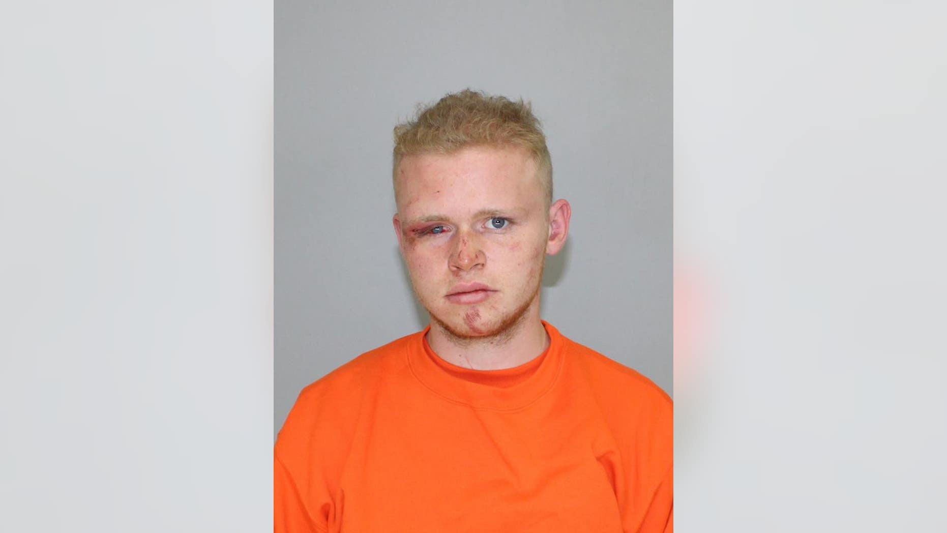 Spencer Fredrickson, 20, was charged with first-degree assault and fourth-degree assault on a peace officer.