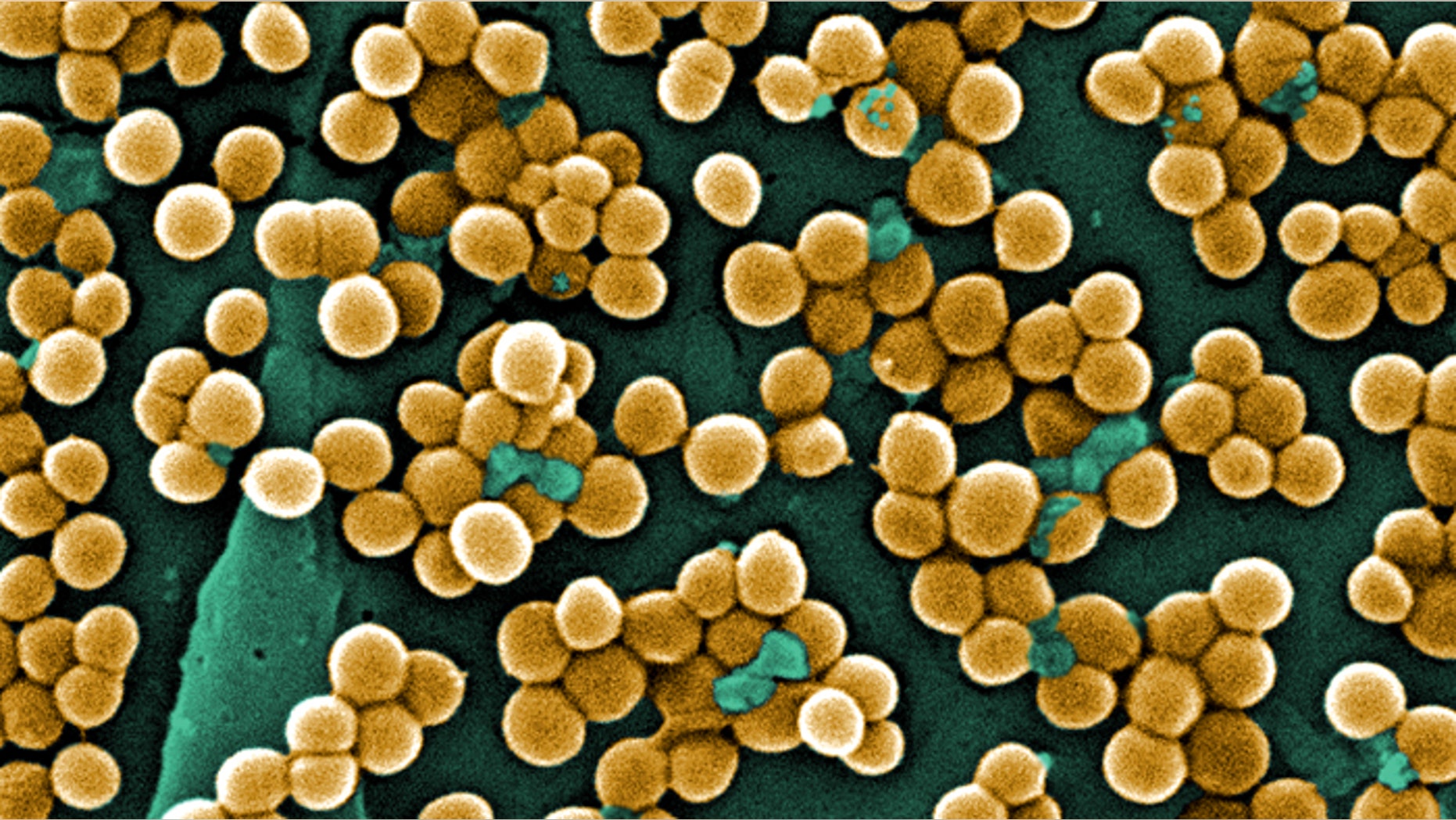This colorized scanning electron micrograph (SEM) depicts numerous clumps of methicillin-resistant Staphylococcus aureus (MRSA) bacteria. It is especially dangerous because it is resistant to many antibiotics.