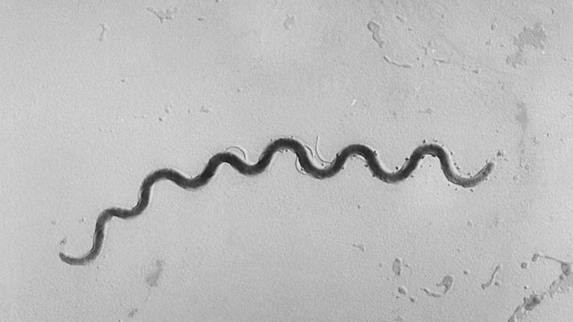 This photomicrograph depicts a Treponema pallidum bacterium, a spirochete 5 to 15 micrometers in length, which is the causative agent of syphilis.