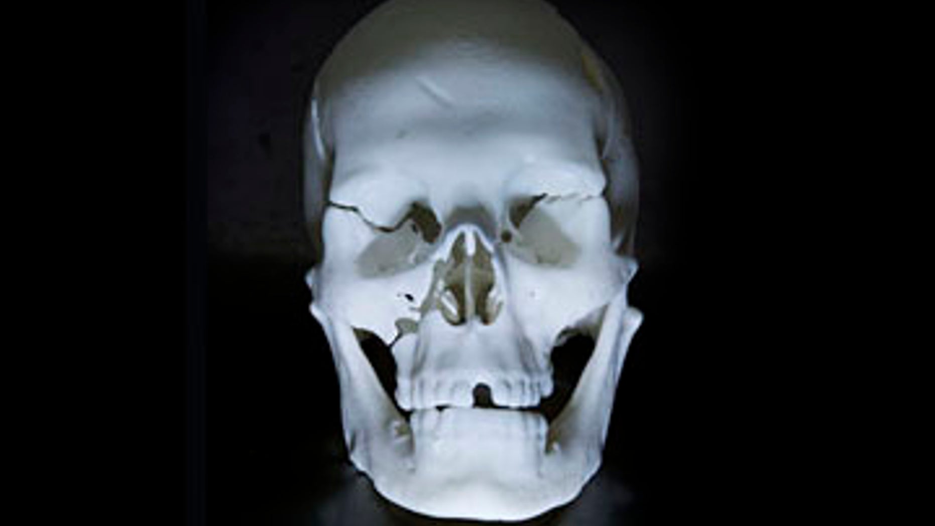 THE SKULL OF KING RICHARD III WHICH HAS BEEN MADE USING 3D PRINTING AT LOUGHBOROUGH UNIVERSITY.PHOTO: ANDY WEEKES / 07836 566295..Loughborough University's 3D printing technology breathes new life into Richard III ..Loughborough's world-leading expertise in 3D printing has been used by the University of Leicester to breathe new life into the remains of King Richard III - creating a replica of his skeleton...Leicester announced today (Monday February 4) that the skeleton found last year in the city by its team of archaeologists is that of Richard III, whose final resting place remained hidden for hundreds of years...In 1485 the King was defeated at the battle of Bosworth. His body, stripped and despoiled, was brought to Leicester where he was buried in the church of the Franciscan Friary, known as the Grey Friars. Over time the exact whereabouts of the Grey Friars became lost...Following extensive research by the University of Leicester, in partnership with Leicester City Council and the Richard III Society, archaeologists were able to locate the former Grey Friars site and unearth the slain King's remains...Experts from Loughborough's School of Mechanical and Manufacturing Engineering were invited to make a replica of the king's skeleton, using the latest 3D printing techniques...Scans of the actual remains taken by the Leicester Royal Infirmary were sent to Loughborough, where they were transformed into a 3D computer model. Laser sintering was then used to create a physical replica of the skeleton. Laser sintering is a technique that uses a high power laser to fuse small particles of materials, in this case plastic, into a mass that has a three-dimensional shape...Professor Russell Harris - head of the University's Additive Manufacturing Research Group - who led Loughborough's involvement in the project, said: ?Generating the first 3D computer models was a very exciting moment. And later seeing the skull of Richard III emerge from the powder of the laser sint