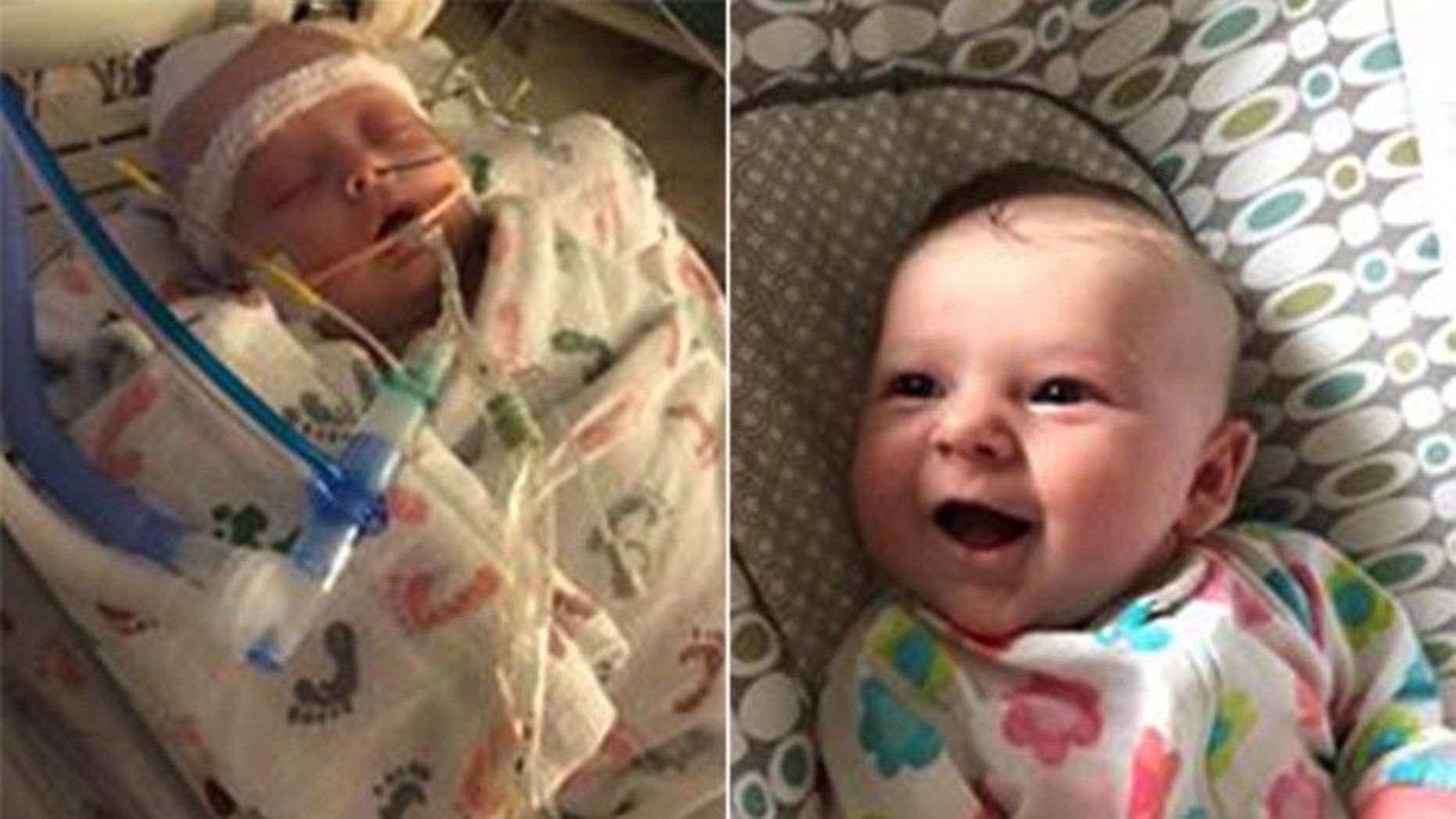 Doctors have told the family of 7-week-old McKenna Hovenga that the infant's brain activity is calming down -- about a week after she was hit in the head with a softball and suffered a traumatic brain injury.