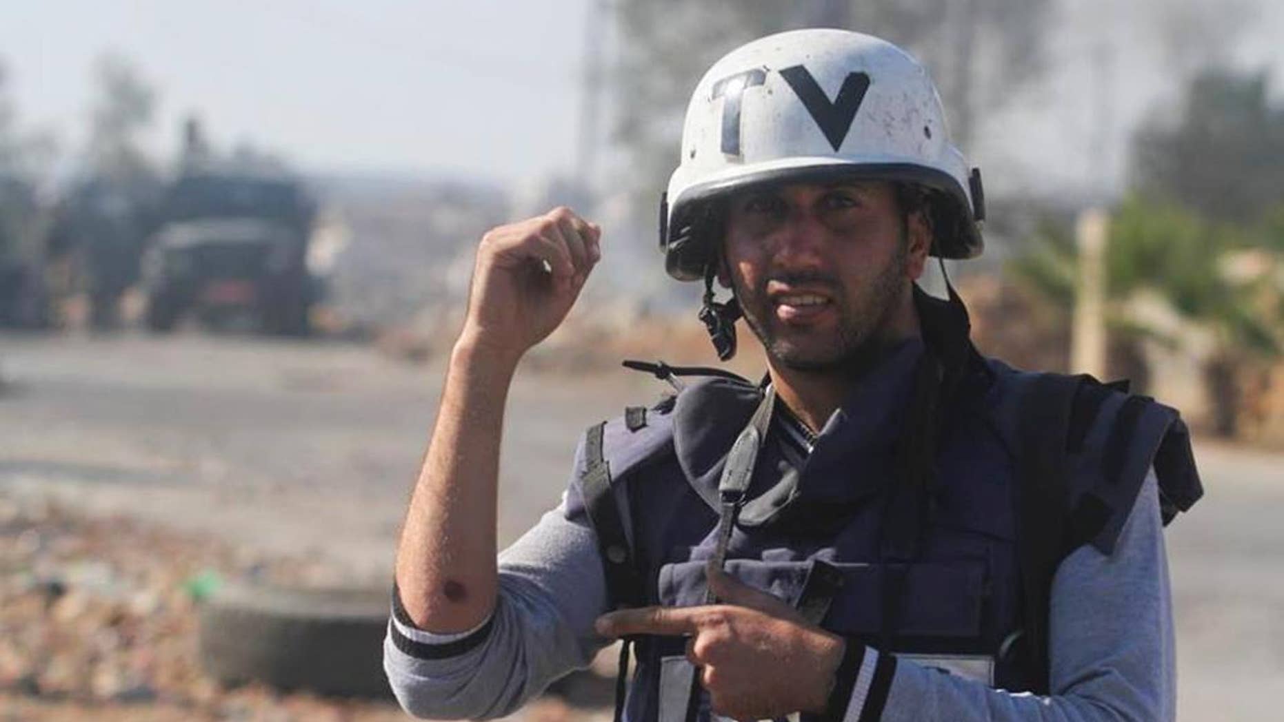 In this Sunday Oct. 26, 2014 photo, Associated Press photographer Majdi Mohammed shows his bruised arm after he was shot with a rubber bullet by Israeli border policeman in the village of Silwad, West Bank. Mohammed was in a group of four photographers taking photos of demonstrations in the West Bank town of Silwad when he was shot on Sunday. Journalists were covering unrest that erupted after the funeral of a 14-year-old Palestinian boy who was killed on Friday in a clash with Israeli soldiers. (AP Photo/Issam Rimawi)