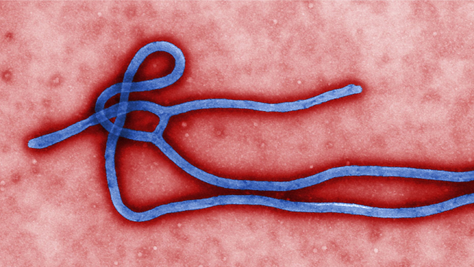 FILE - This undated file image made available by the Centers for Disease Control (CDC) shows the Ebola virus.