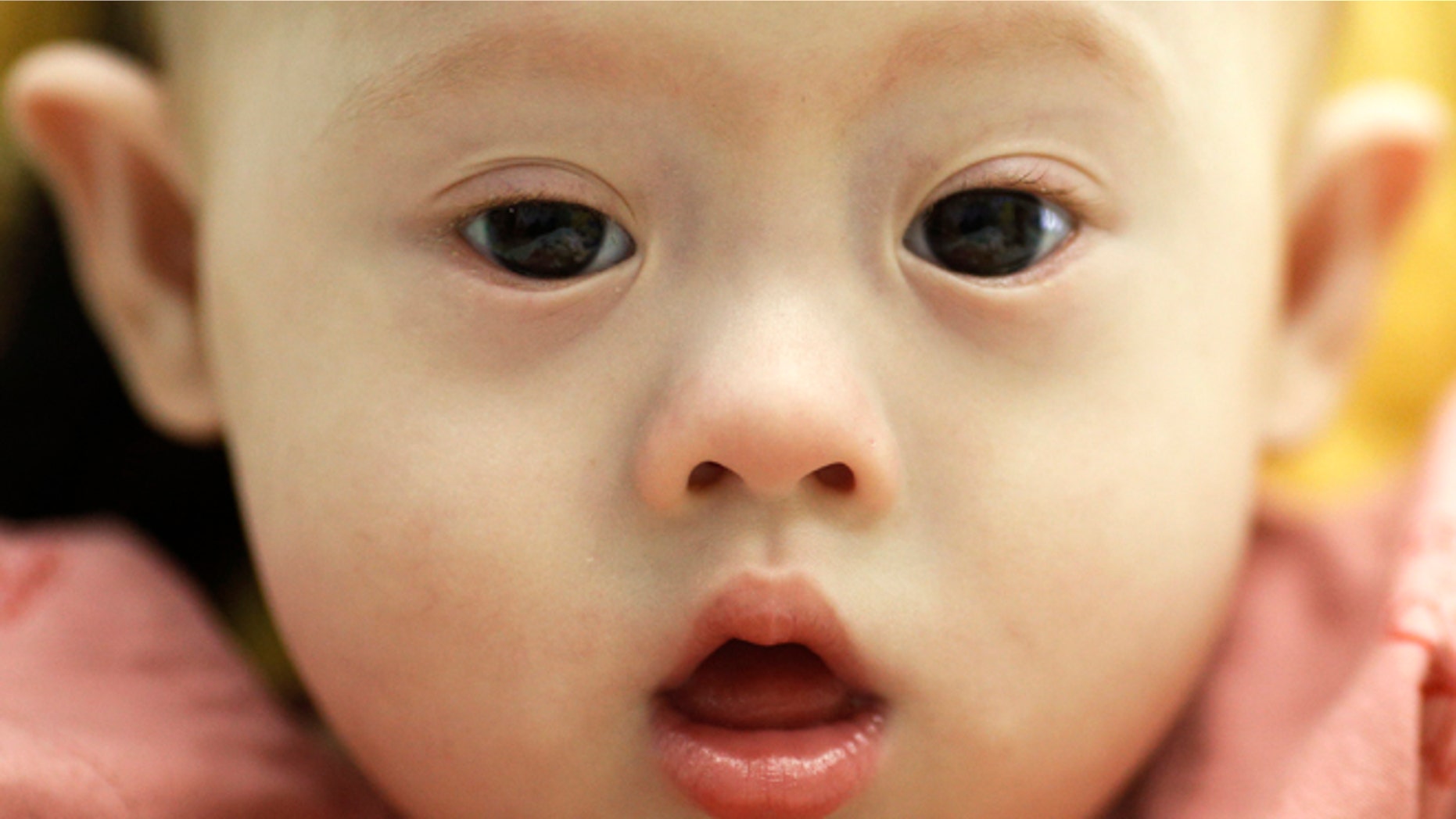 Gammy, a baby born with Down's Syndrome, is held by his surrogate mother Pattaramon Janbua (not seen) at a hospital in Chonburi province August 3, 2014. According to Pattaramon, his Australian parents, through a local surrogate agency, asked her at her 7th month of pregnancy to terminate it because of his Down's Syndrome but she refused and kept the baby. The Australian parents instead took with them Gammy's twin sister who was born healthy. More than 3 million Thai baht ($93,360) was raised through an online campaign in Thailand in less than a day for the medical treatment of Gammy who suffers from potentially life threatening heart conditions and a serious lung infection, local media reported. REUTERS/Damir Sagolj (THAILAND - Tags: SOCIETY HEALTH) - RTR411O6