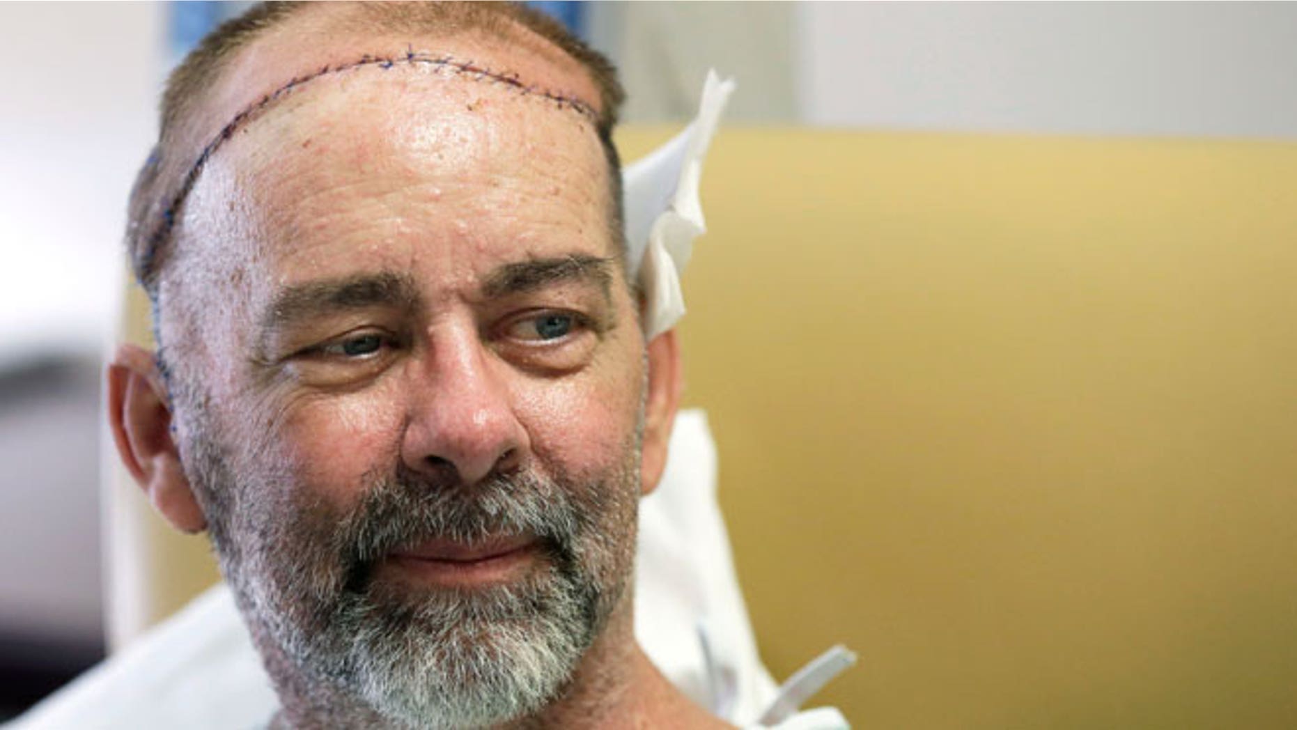 In this photo taken on Wednesday, June 3, 2015, James Boysen is interviewed in his hospital bed at Houston Methodist Hospital in Houston. Texas doctors say he received the world's first skull and scalp transplant from a human donor to help heal a large head wound from cancer treatment.