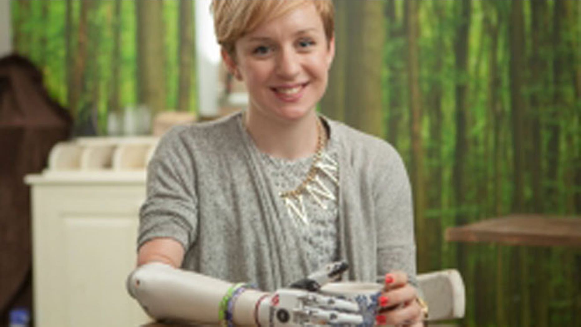 Nicky Ashwell, 29, was the first person in the United Kingdom to be fitted with the bebionic small hand.