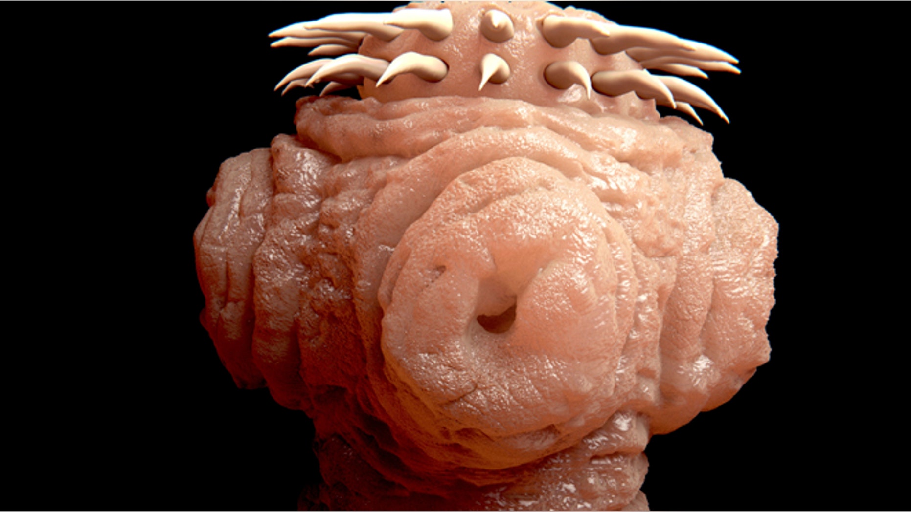 A look at a tapeworm under a microscope.