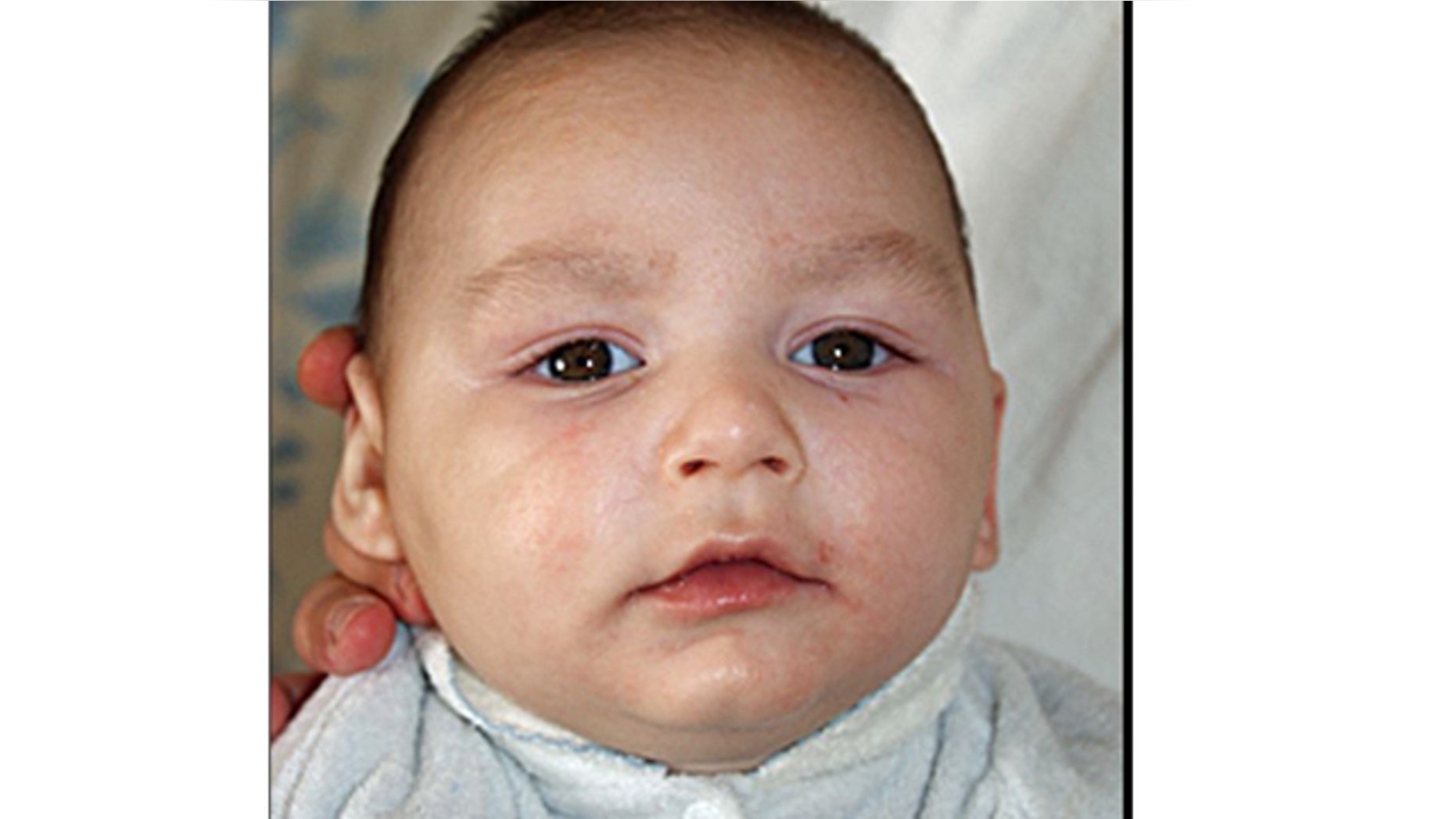 “Baby Joseph” undergoes a tracheotomy and is set to have his tracheotomy tube changed for the first time in a few days. Doctors called the procedure an important step toward his transfer to a skilled nursing facility