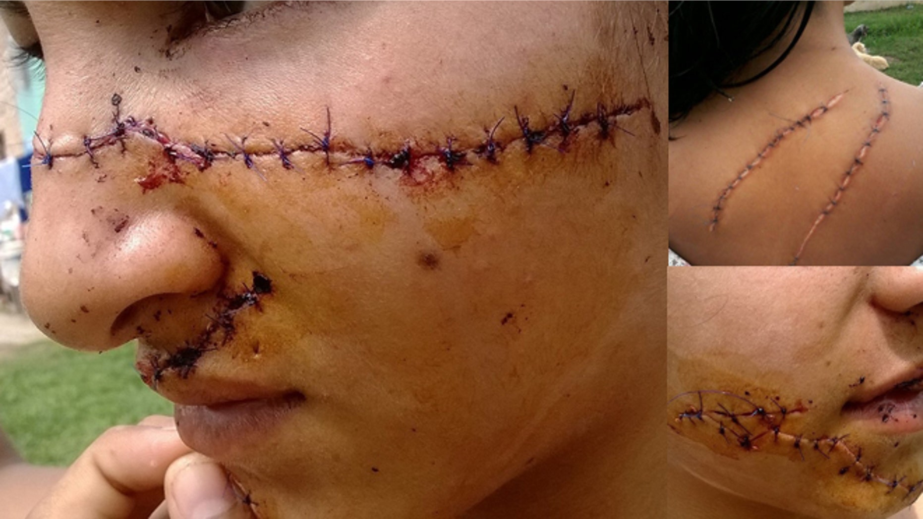 Photos of Julia Alvarez posted and shared on her sister's Facebook page.