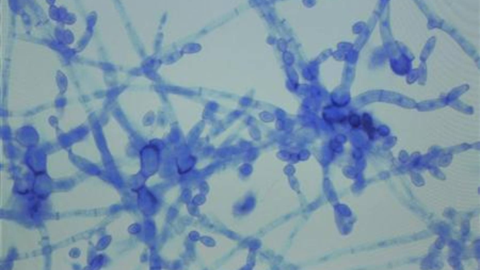 A sample of Cladosporium species, one of the fungi diagnosed in the fungal meningitis outbreak sweeping the United States. REUTERS/Harrison McClary