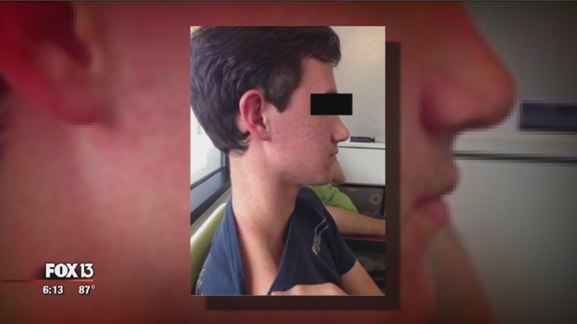 Unidentified teen went to a walk-in clinic exhibiting a fever and rash.
