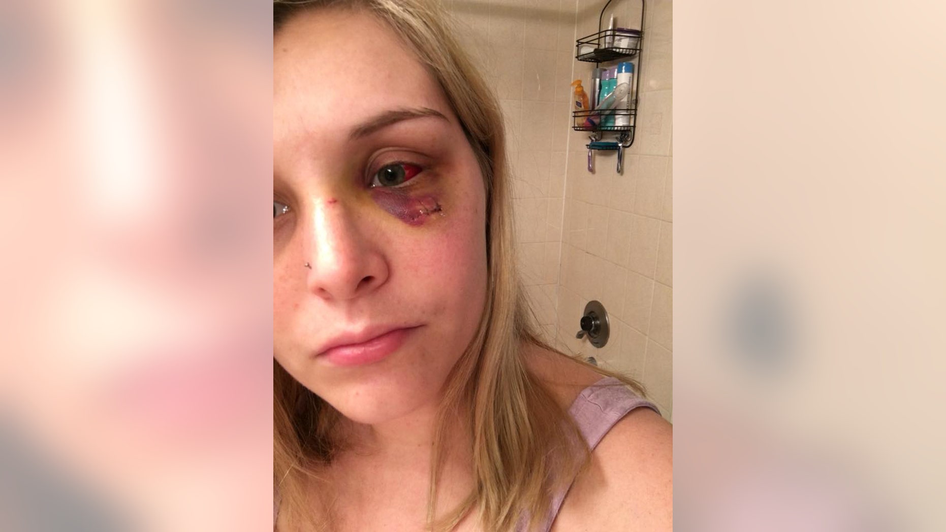 Amanda Comparetto, 23, is hoping to find the man who punched her in the face at a Florida bar.
