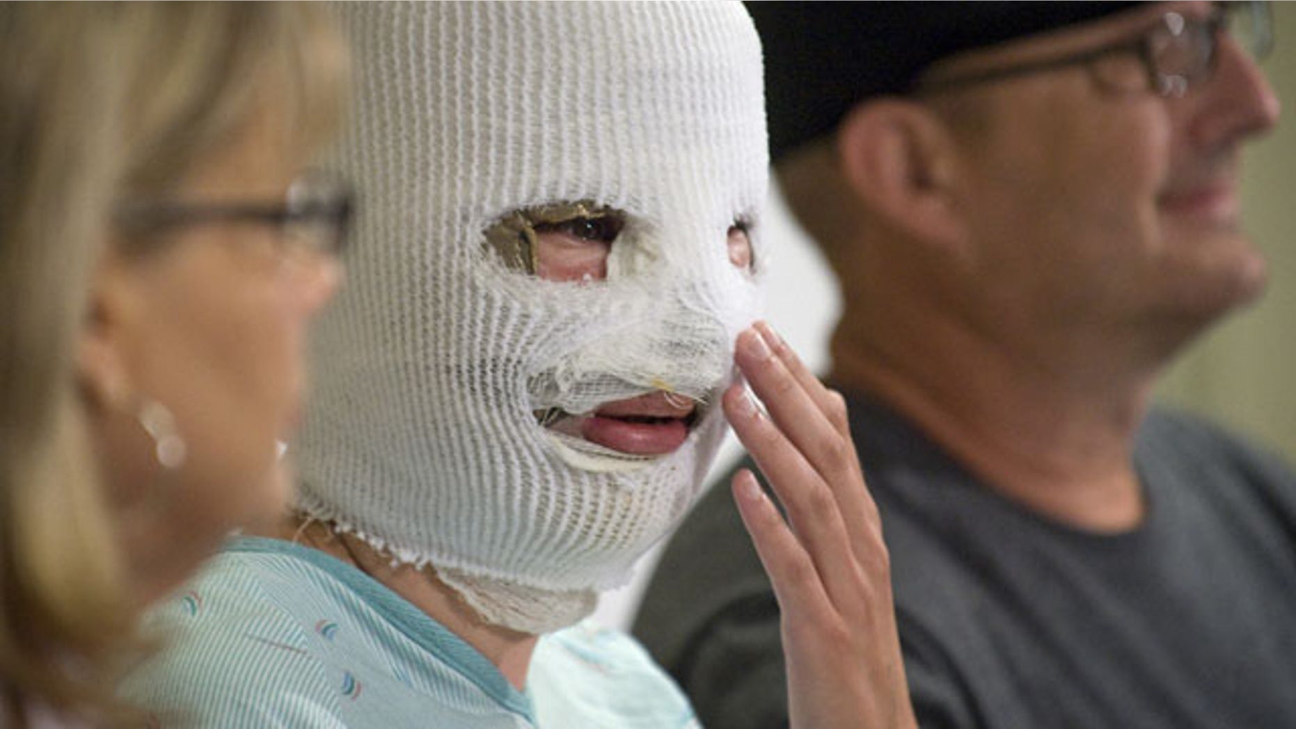 Police say Bethany Storro, pictured above, threw acid in her own face.