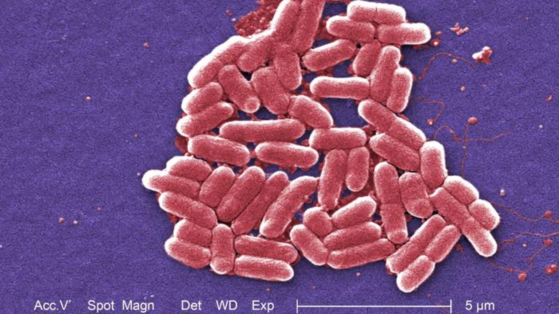 This colorized scanning electron micrograph (SEM) depicts a number of Escherichia coli (E. coli) bacteria.