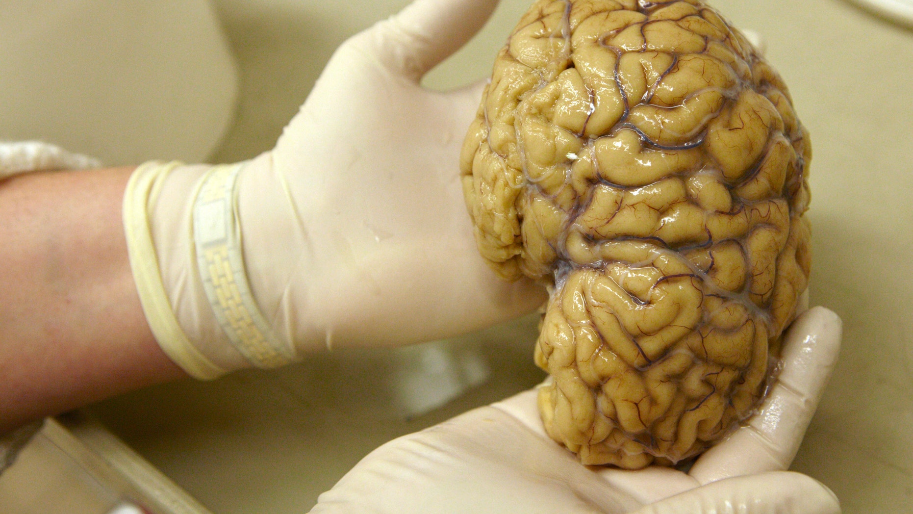 File photo - A laboratory assistant holds one hemisphere of a healthy brain in the Morphological unit of psychopathology in the Neuropsychiatry division of the Belle Idee University Hospital in Chene-Bourg near Geneva in a March 14, 2011 file photo. (REUTERS/Denis Balibouse/files)