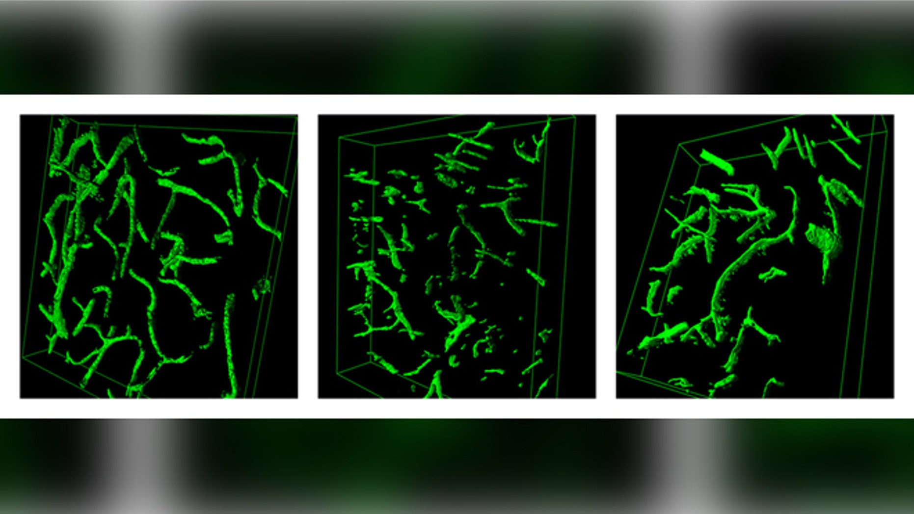 This combination of images shows 3-D reconstructions of brain blood vessels in, from left, a young mouse, an old mouse, and an old mouse who was exposed to the blood of a young mouse. (AP Photo/Lida Katsimpardi)