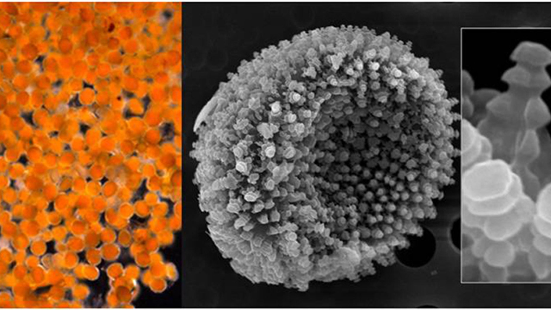 A magnified views of an orange goo that appeared Aug. 3, 2011 along the shore of the village of Kivalina, Alaska. The goo turned out to be fungal spores, not millions of microscopic eggs as indicated by preliminary analysis, scientists said Thursday, Aug. 18, 2011.