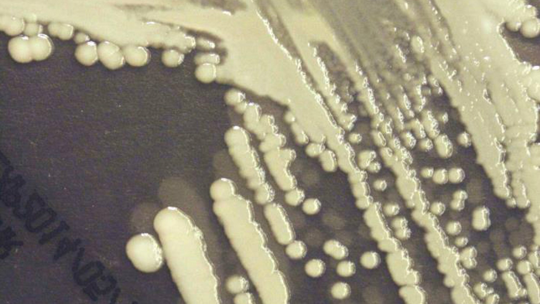 Anthrax is a serious infectious disease caused by gram-positive, rod-shaped bacteria known as Bacillus anthracis.
