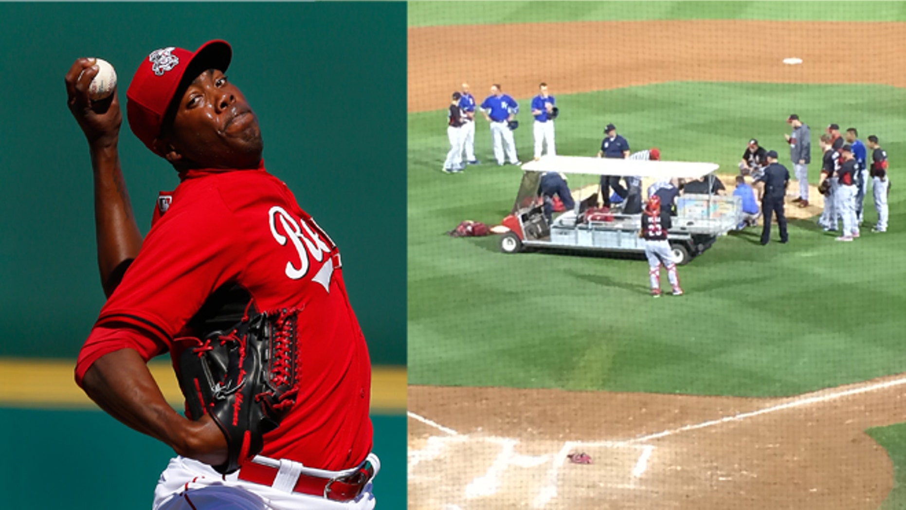In this image (right) provided by Mark Sheldon Cincinnati Reds closer Aroldis Chapman is taken off the field after being hit by a line drive Wednesday night March 19, 2014, another frightening incident involving a pitcher being struck by a batted ball. Chapman broke bones above his left eye and nose. He is undergoing further testing at Banner Good Samaritan Medical Center, where he will spend the night for observation, according to a statement from the Reds.
