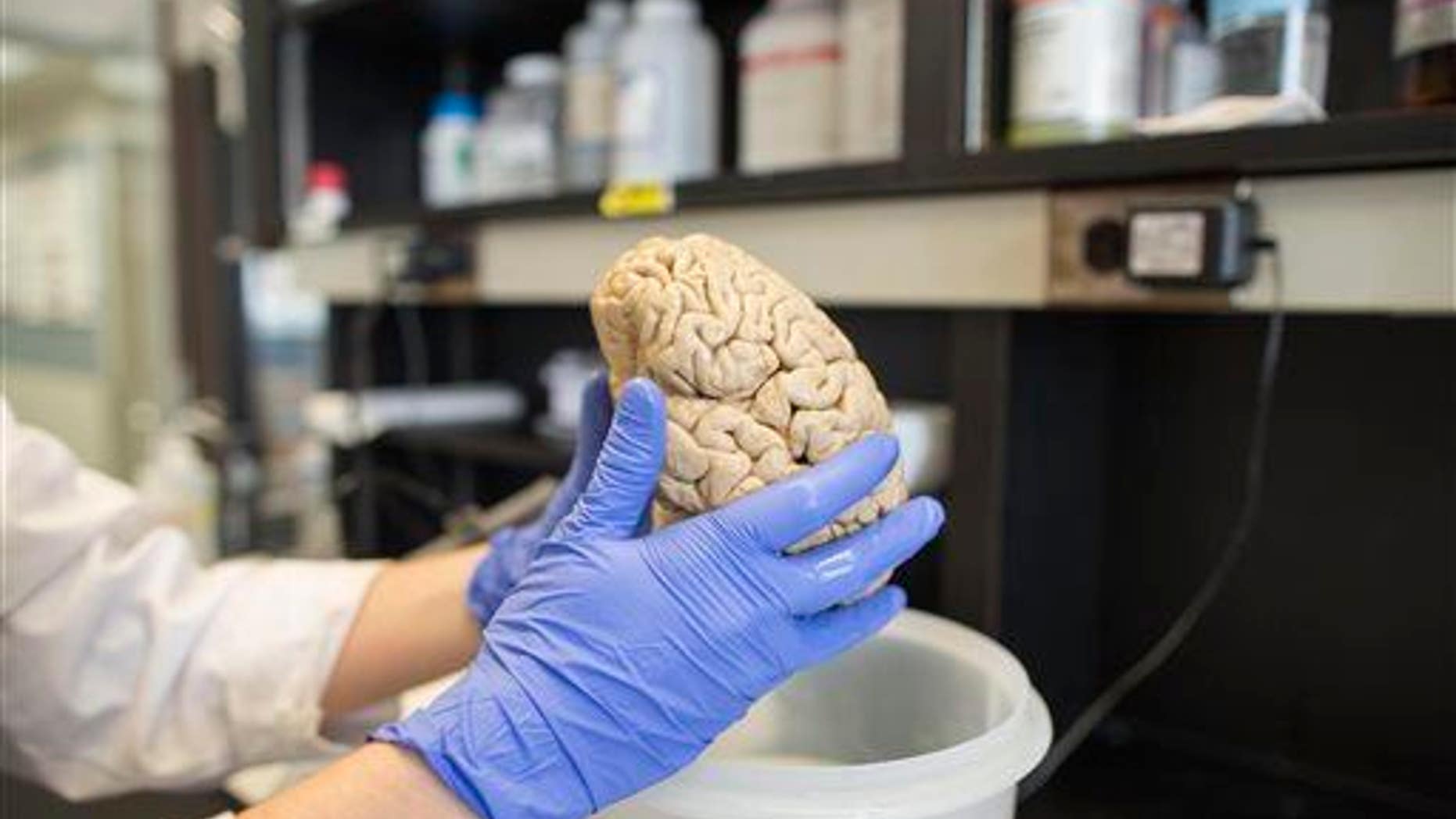 In this July 29, 2013 photo, a researcher holds a human brain in a laboratory at Northwestern University's cognitive neurology and Alzheimer's disease center in Chicago.