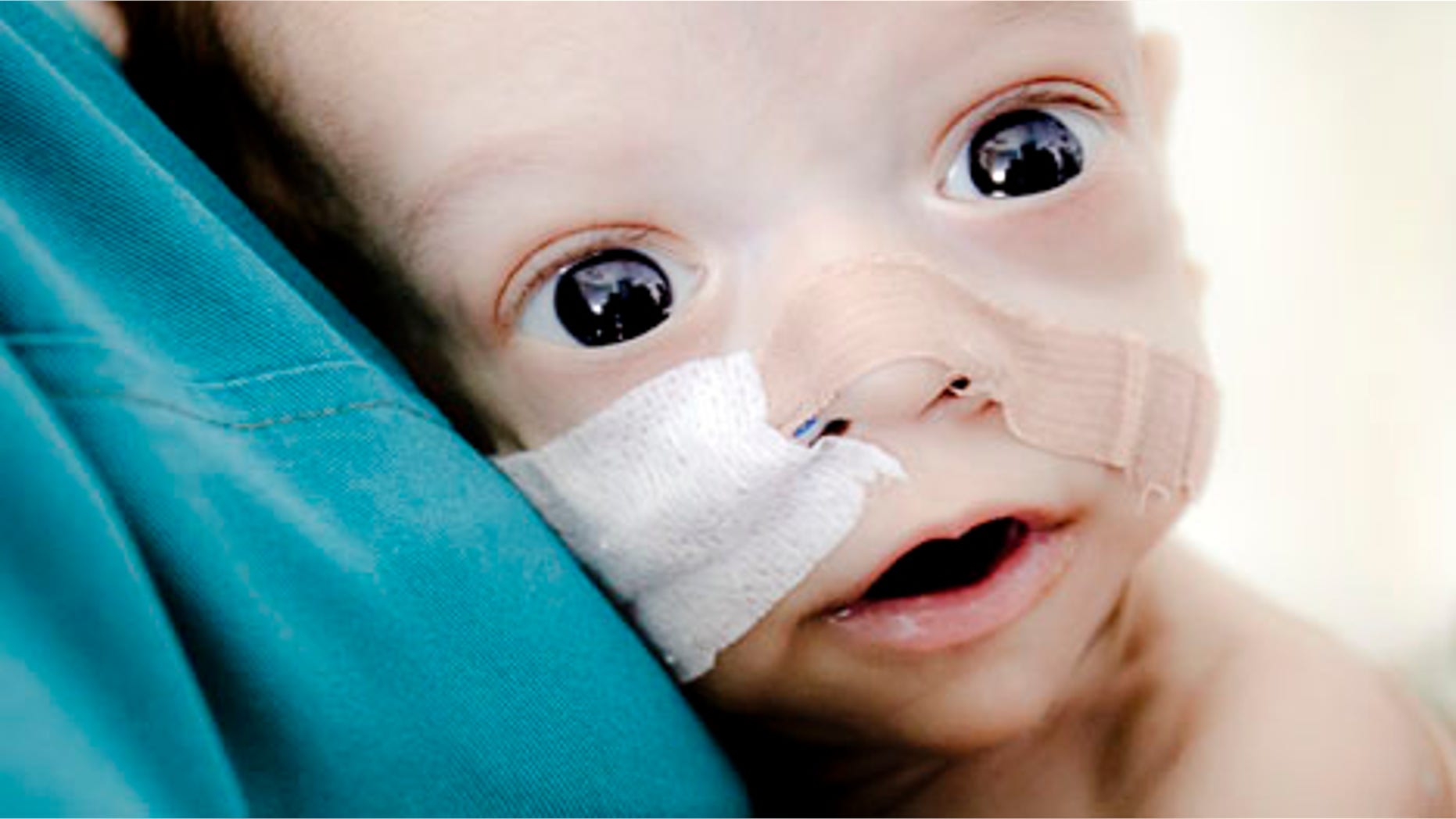 Baby Andrei, a Romanian baby born with virtually no intestines who confounded doctors by clinging to life and captured international attention for his fighting spirit, has died. (AP Photo/Vadim Ghirda, file)