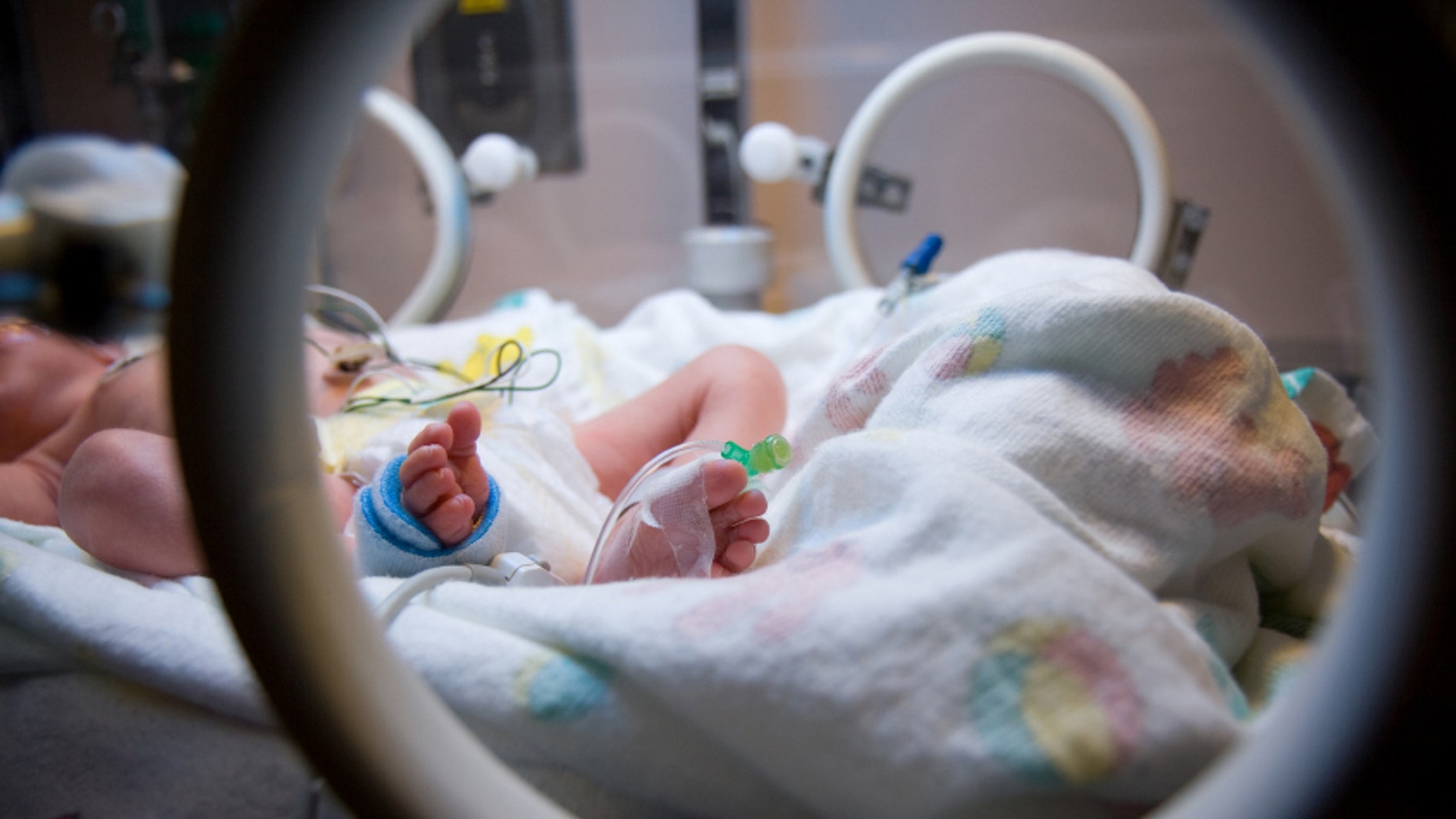 A premature infant in the NICU.