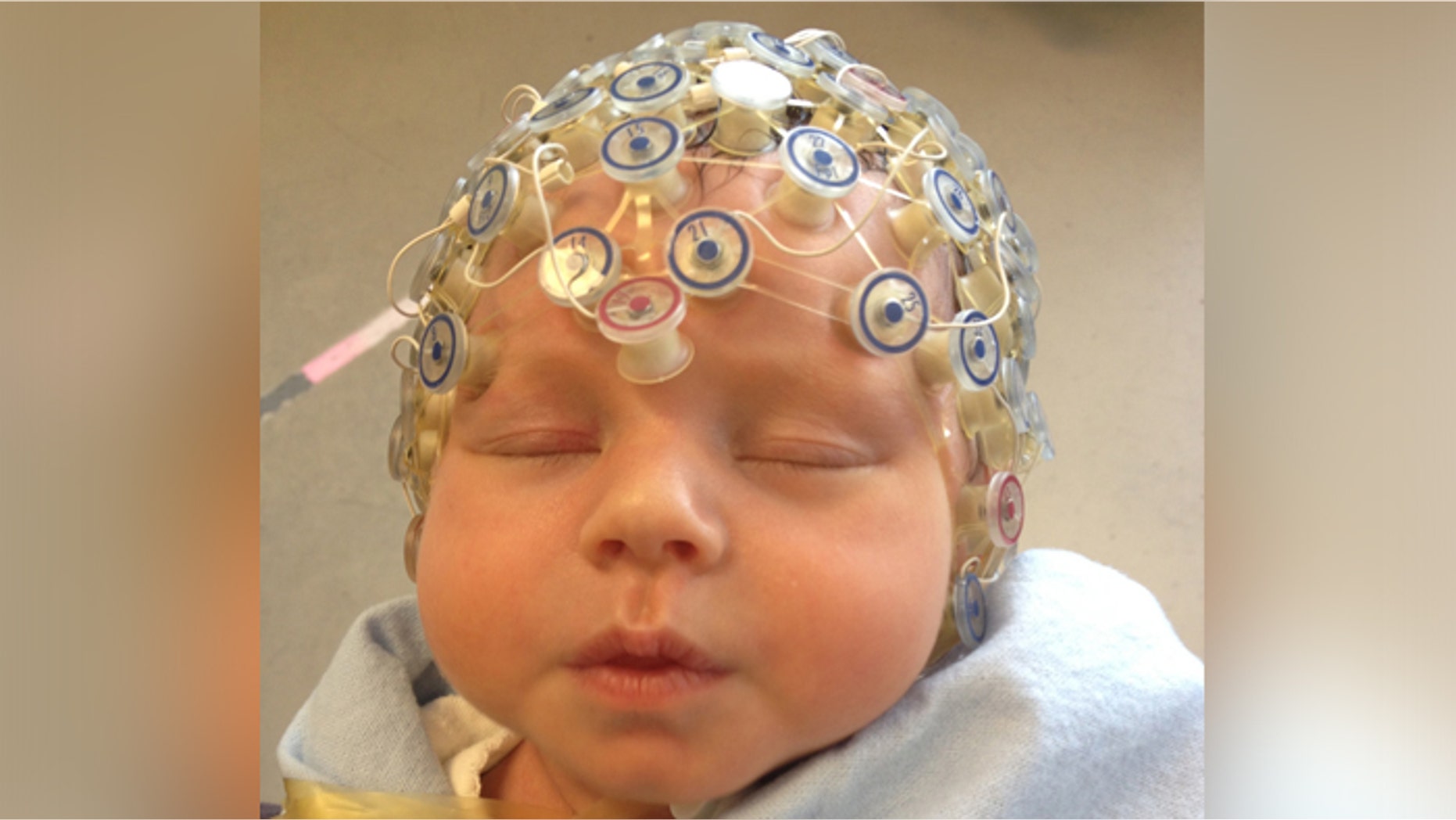 Baby undergoing electroencephalography.