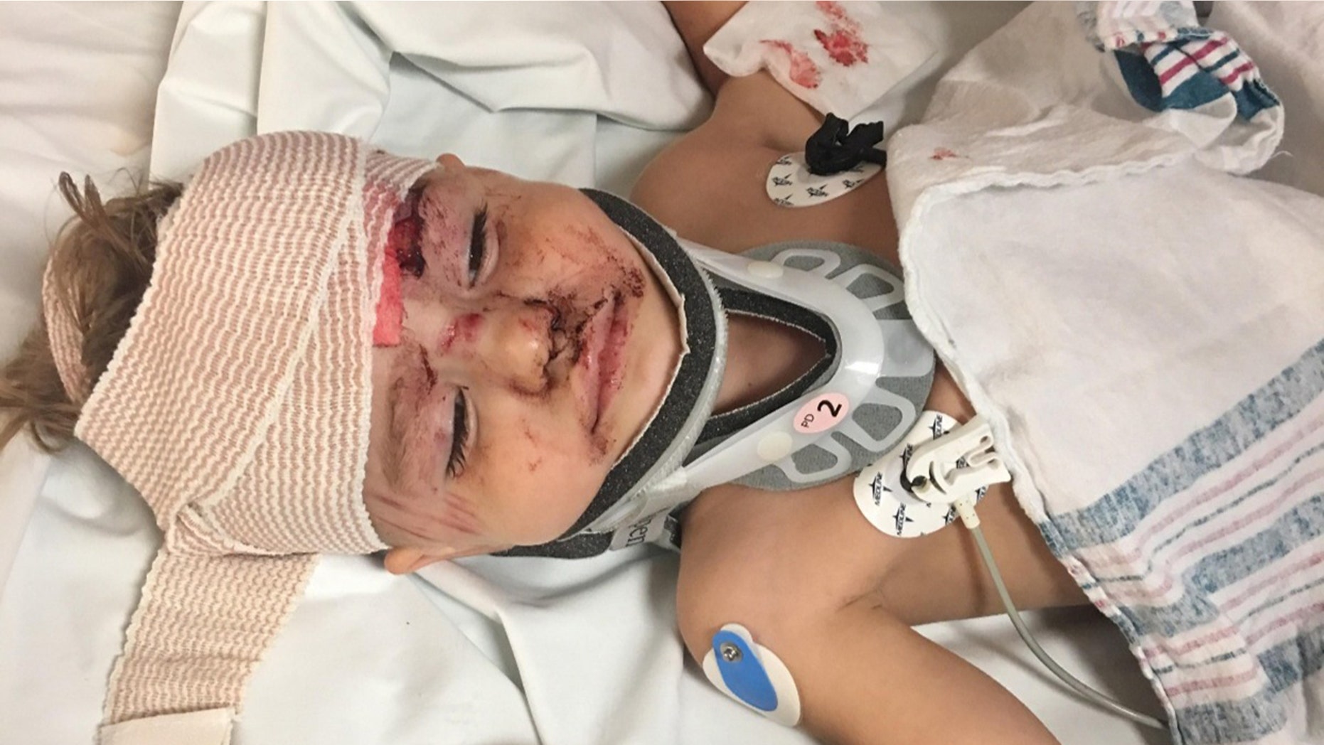Kayden Blodgett, 2, was injured after a Tennessee deputy allegedly hit him with their cruiser, the boy's family says.