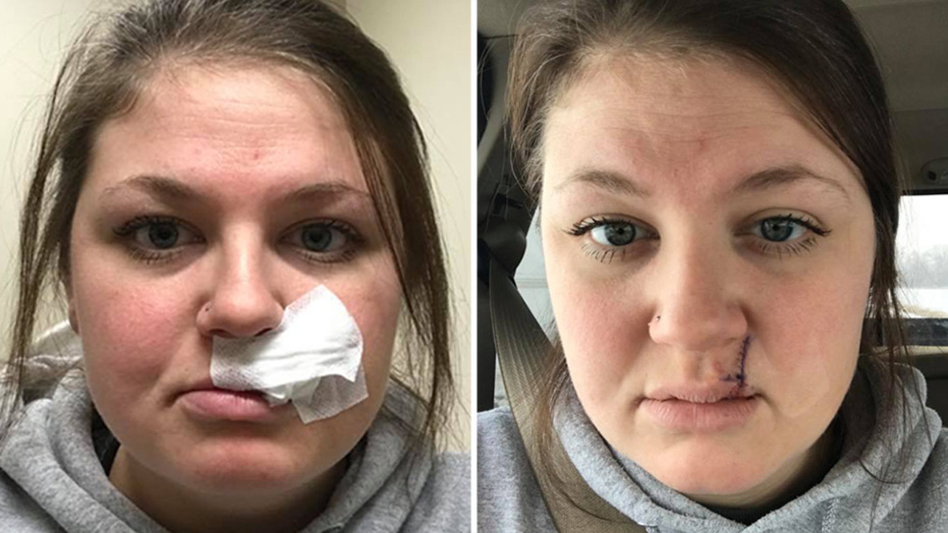 The mom of two took to Facebook with a critical skincare message.
