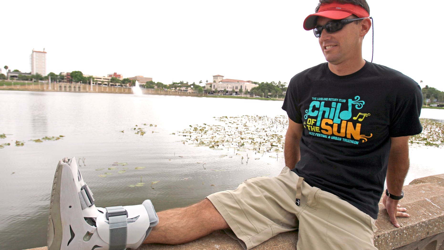 Greg Farris rests his foot that he injured while running in barefoot running shoes.(AP Photo/John Raoux)