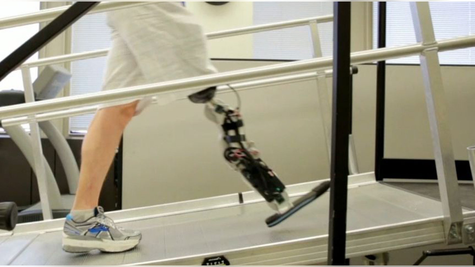 Zac Vawter, who lost his leg below the knee after a motorcycle accident four years, is the first amputee with a thought-controlled bionic leg.