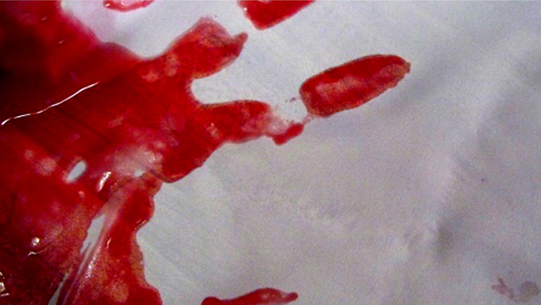 Calculating the speed at which drops of blood leave the body during an attack is an important measurement for blood pattern analysis.