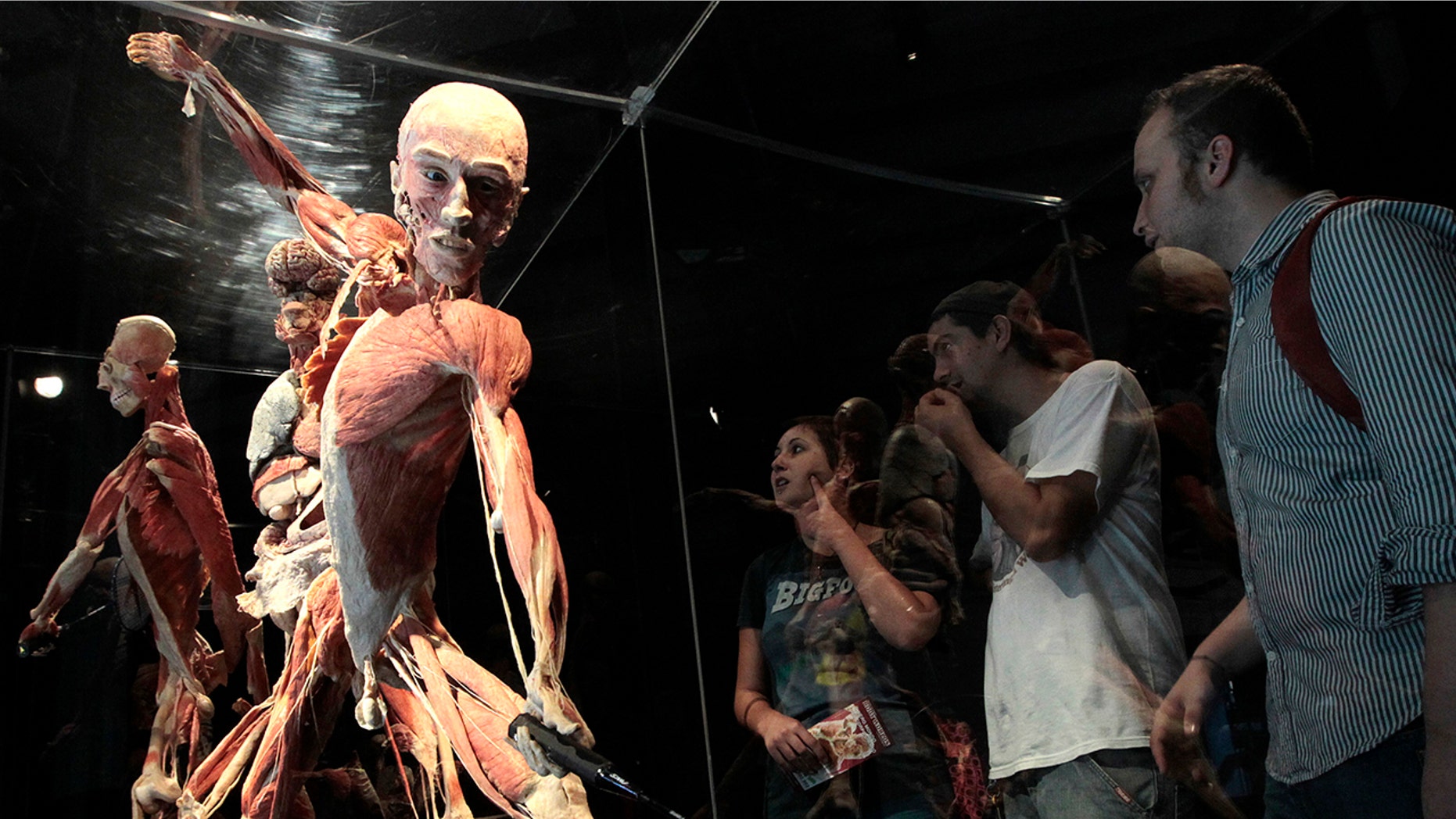 A New Zealand man is accused of stealing two toes, worth thousands of dollars, from a Body Worlds exhibition in Auckland.