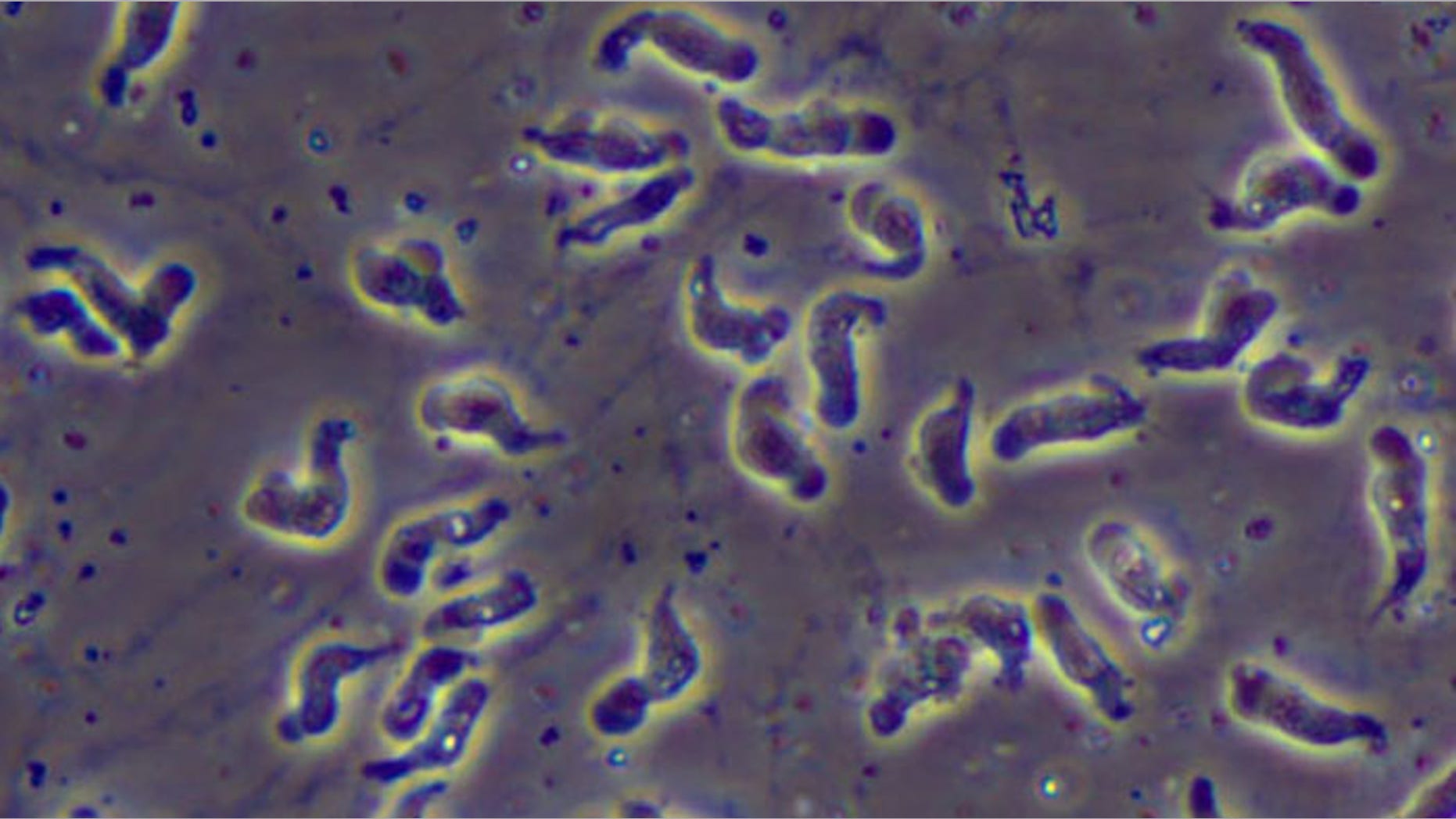 Naegleria fowleri, the brain-eating amoeba that causes primary amebic meningoencephalitis.