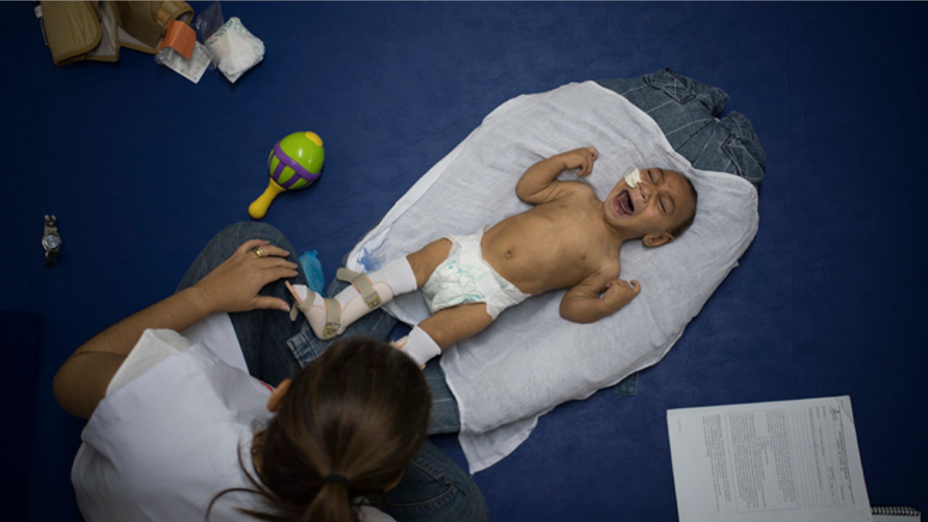 Jose Wesley Campos, 1, was born with microcephaly in Recife, Brazil.