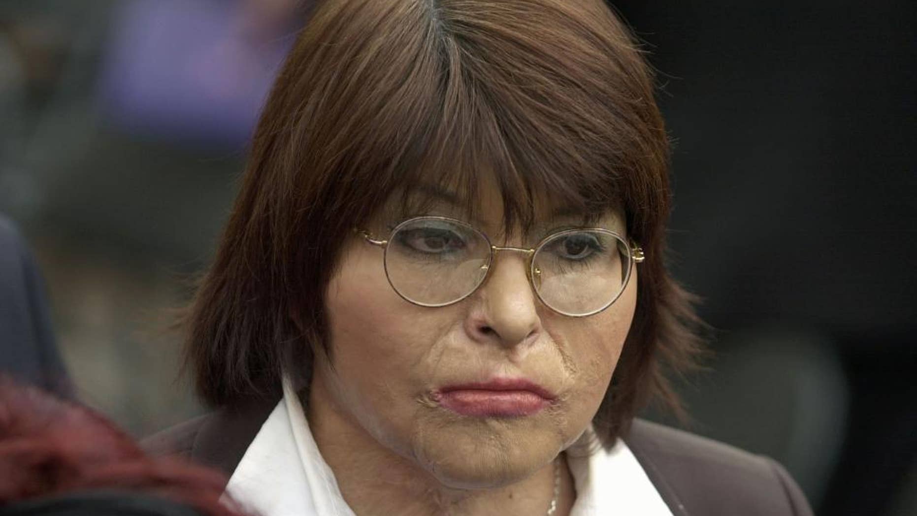 FILE - In this Sept. 11, 2003 file photo, Chilean Carmen Gloria Quintana attends a ceremony marking the 30th anniversary of the Sept. 11 military coup lead by Gen. Augusto Pinochet at the government palace La Moneda, in Santiago, Chile. On July 21, 2015, a Chilean judge ordered the arrest of seven officers in the fatal burning of a 19-year-old U.S. resident who died in a 1986 protest against the military dictatorship then in power. Soldiers doused 19-year-old Rodrigo Rojas and 18-year old Carmen Quintana with gasoline and set them ablaze during a street demonstration on July 2, 1986. Rojas died four days later. Quintana survived and underwent lengthy recovery treatment for severe burns at a Canadian hospital. (AP Photo/Santiago Llanquin, File)