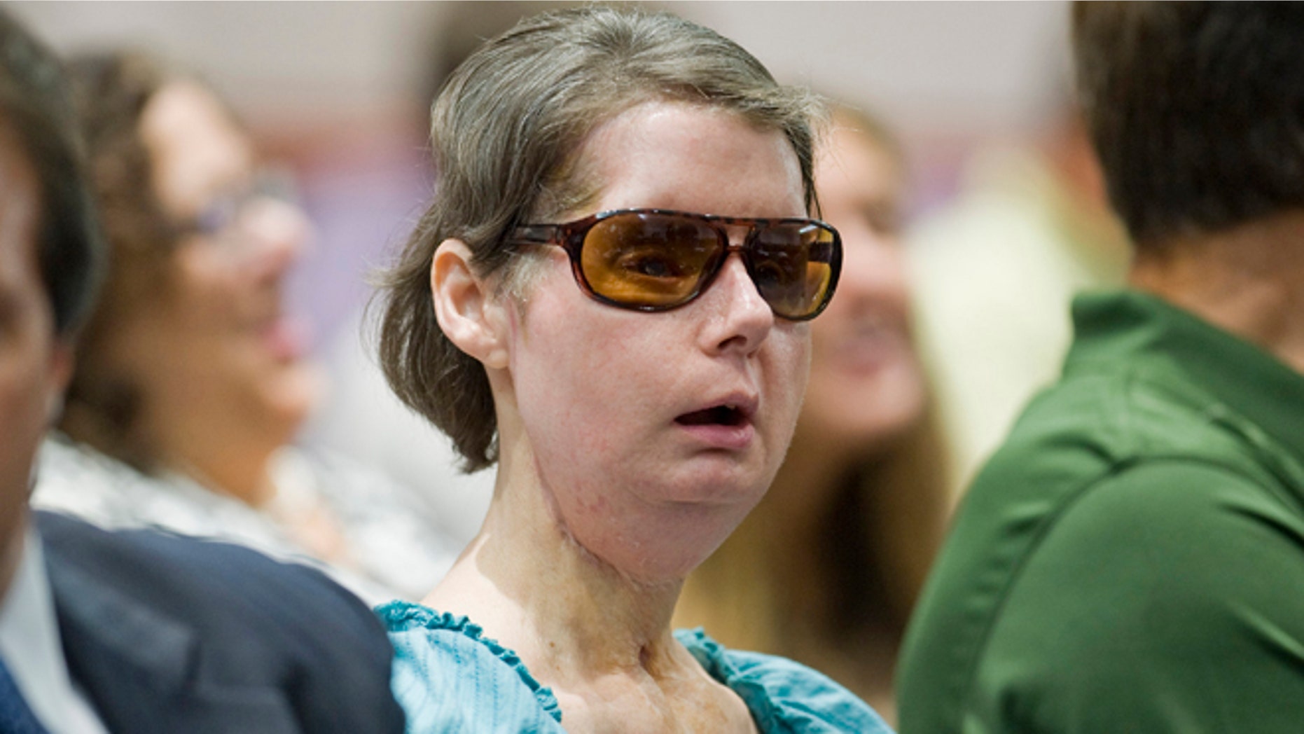 August 2012: Charla Nash sits before a hearing at the Legislative Office Building in Hartford, Conn., to determine whether she may sue the state for $150 million in claimed damages.