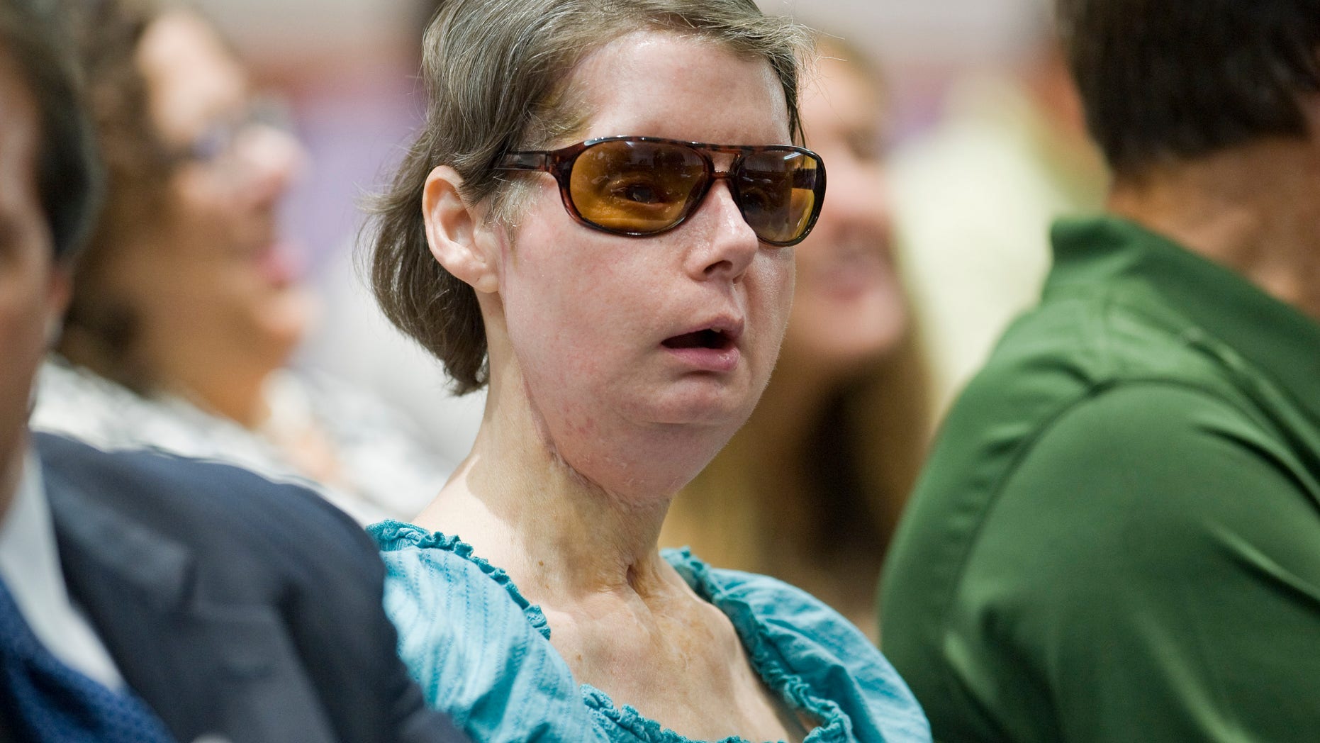 Aug. 10, 2012: File photo, Charla Nash sits before a hearing at the Legislative Office Building in Hartford, Conn. Lawyers for Nash, who was mauled by a chimpanzee in Connecticut, have agreed to settle a lawsuit against the estate of the primate's now-dead owner.