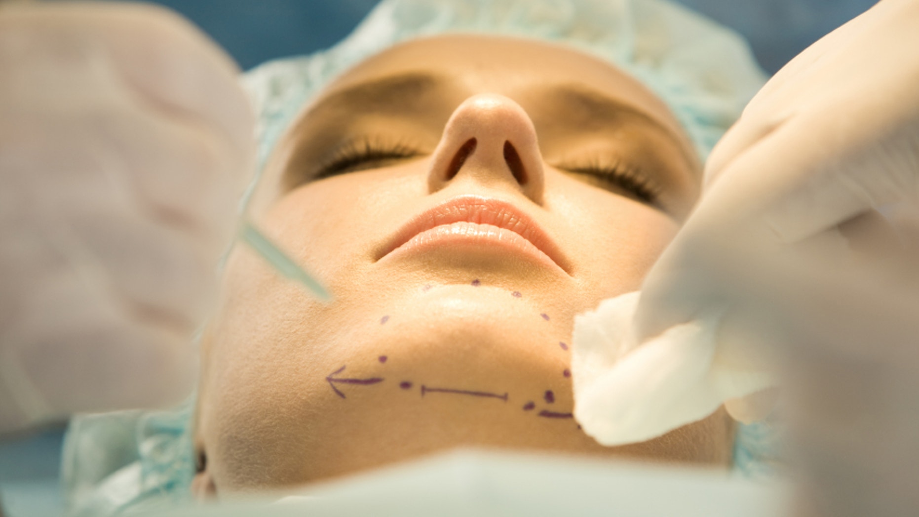 Close-up of patients chin with marks before operation