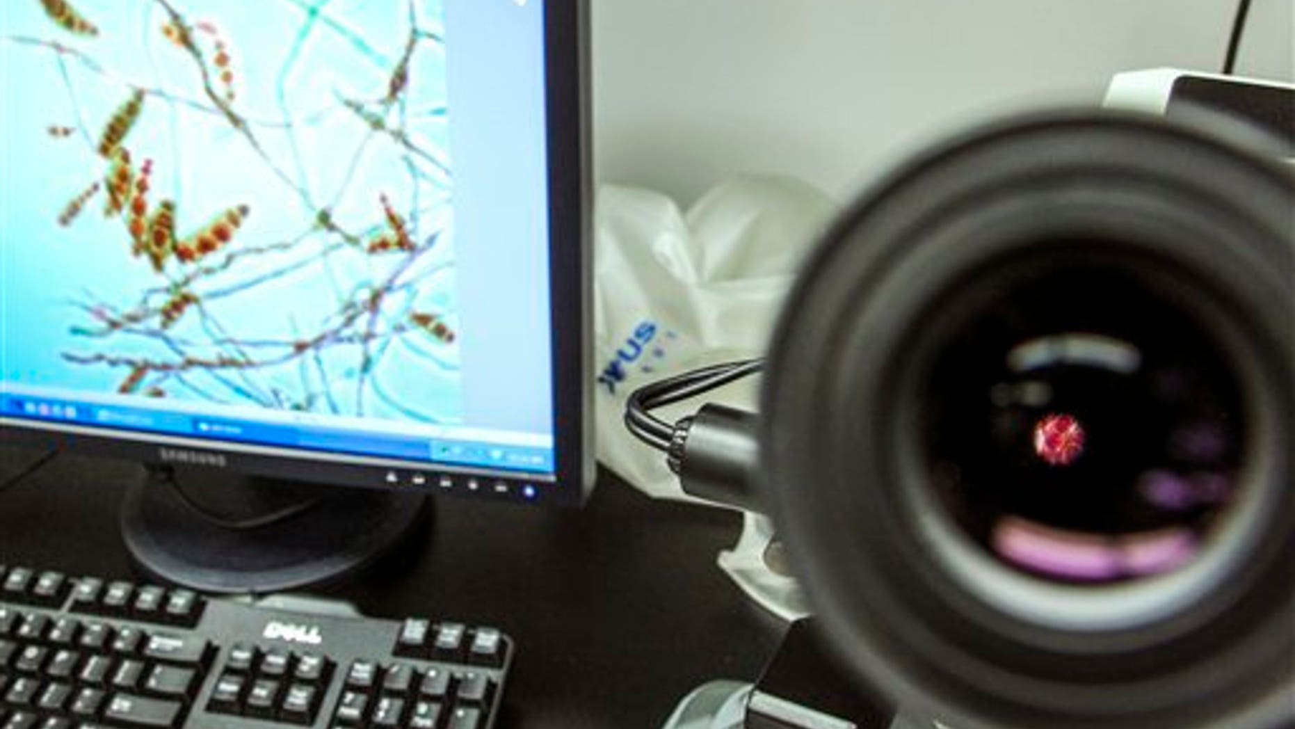Close-up view, through the lens of a microscope and magnified on the computer screen, of the meningitis causing fungus.