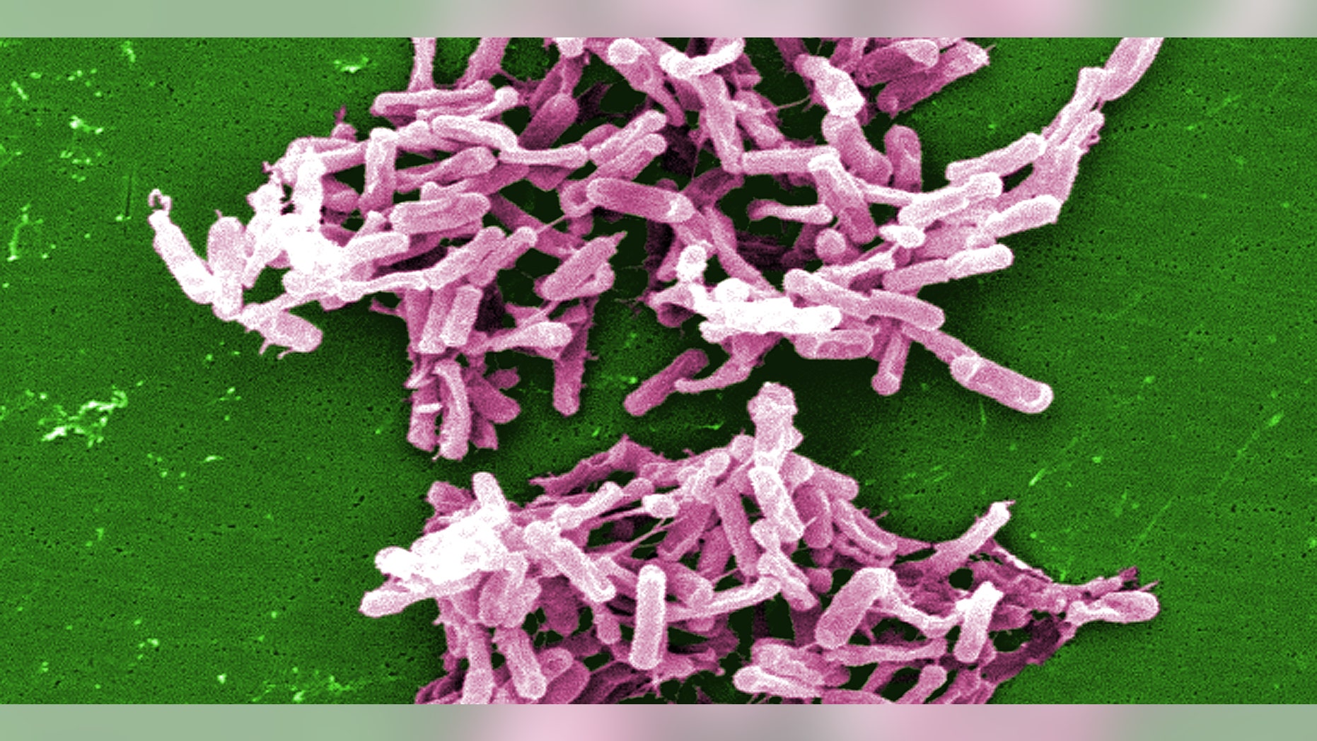 This micrograph depicts Gram-positive C. difficile bacteria from a stool sample culture.