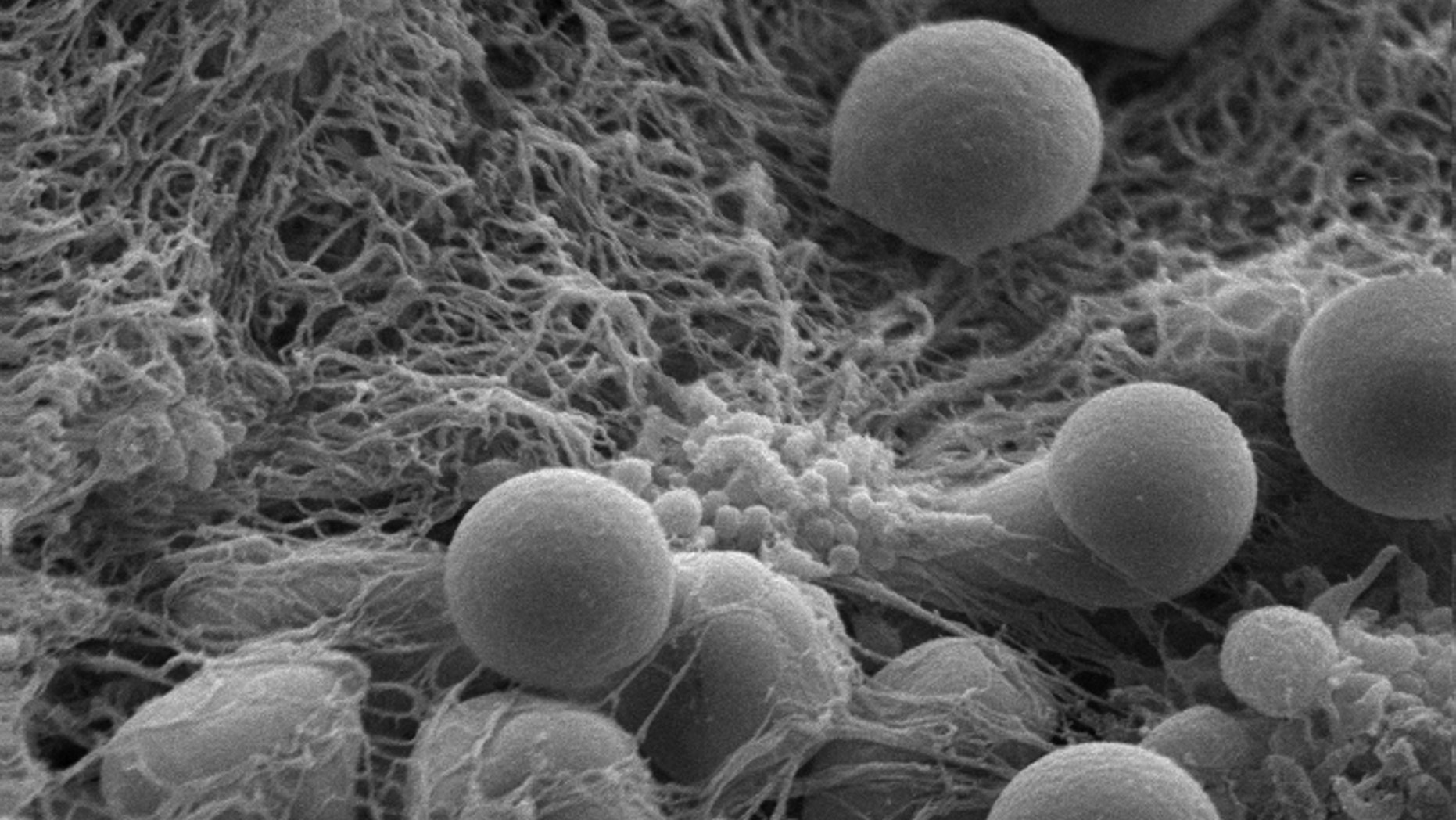 Hemostatic nanoparticles accumulate on a clot-stabilizing mesh of fibrin the body produces.